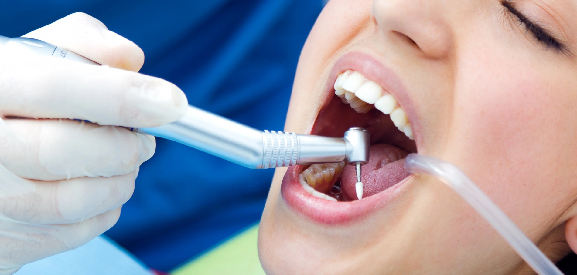 Top 10 Famous Dentist Clinics & Hospitals in San Francisco, USA