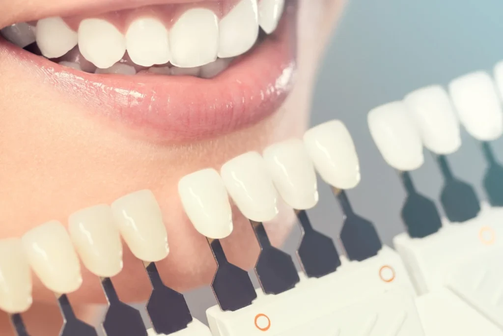 Top 10 Famous Dental Clinics & Hospitals in San Francisco, USA — 2025